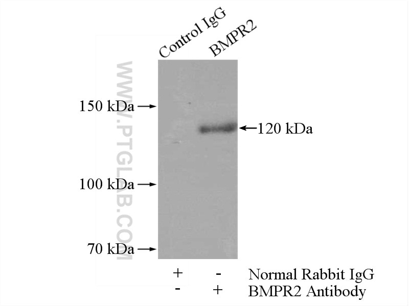 Immunoprecipitation (IP) experiment of mouse brain tissue using BMPR2 Polyclonal antibody (19087-1-AP)