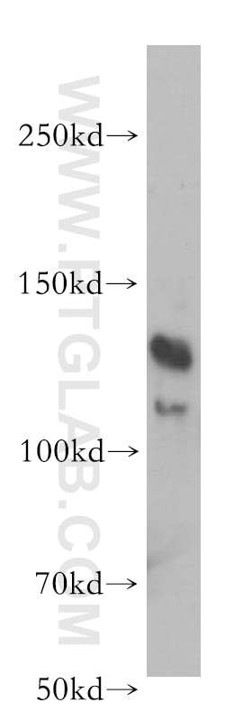 Western Blot (WB) analysis of mouse brain tissue using BMPR2 Polyclonal antibody (19087-1-AP)