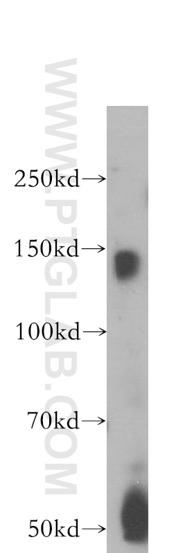 Western Blot (WB) analysis of human heart tissue using BMPR2 Polyclonal antibody (19087-1-AP)