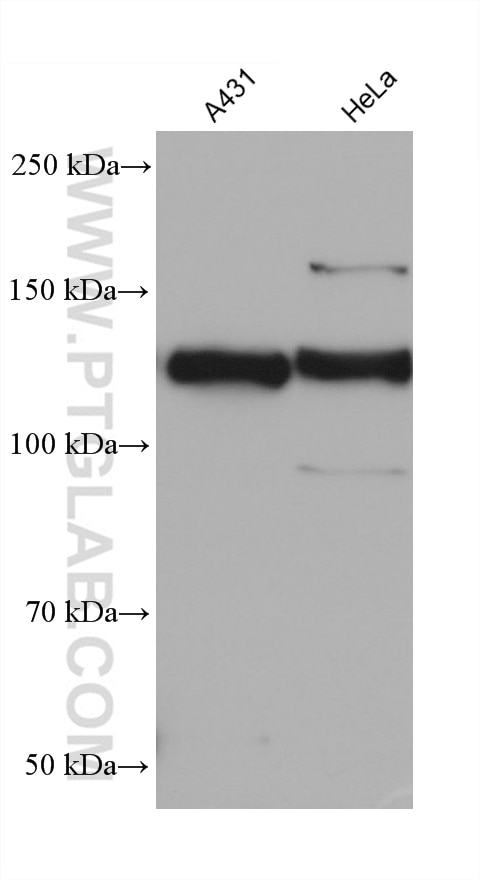 Western Blot (WB) analysis of various lysates using BMPR2 Monoclonal antibody (68497-1-Ig)