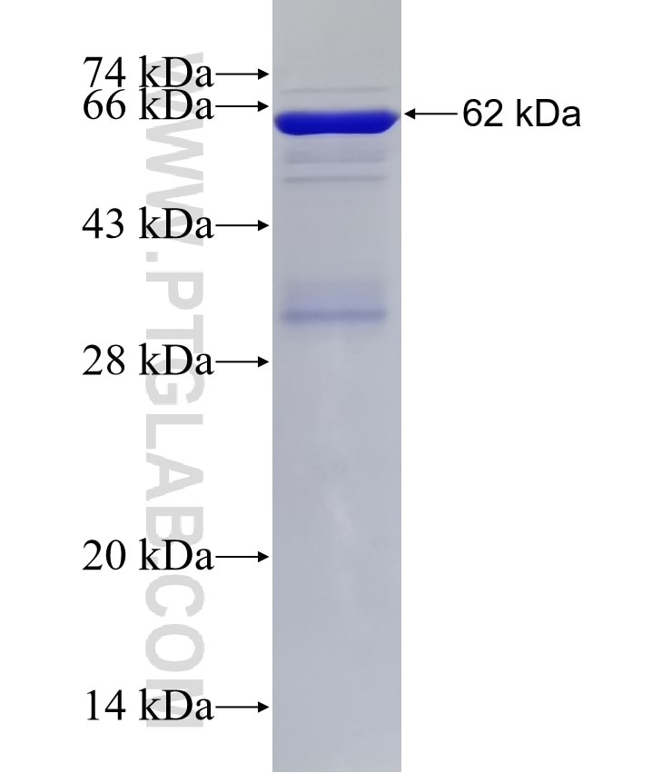 BMPR2 fusion protein Ag5752 SDS-PAGE