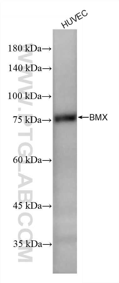 HUVEC cells were subjected to SDS PAGE followed by western blot with 87023-4-RR (BMX antibody) at dilution of 1:5000 incubated at room temperature for 1.5 hours. This data was developed using the same antibody clone with 87023-4-PBS in a different storage buffer formulation. Western Blot (WB) analysis of HUVEC cells using BMX Recombinant monoclonal antibody (87023-4-RR)