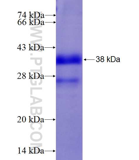 BNC1 fusion protein Ag27161 SDS-PAGE