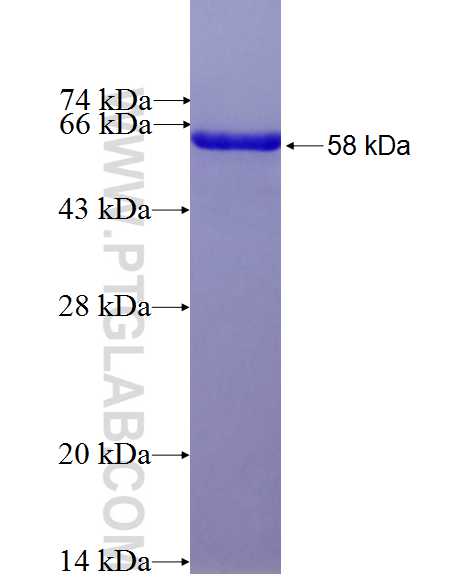 BNC1 fusion protein Ag27185 SDS-PAGE