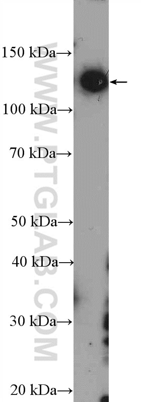 WB analysis of HeLa using 55220-1-AP