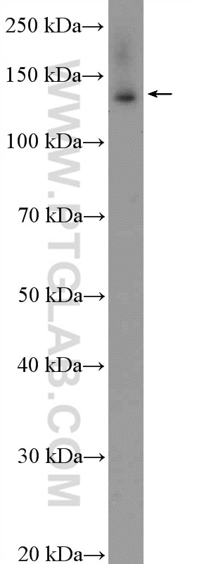 Western Blot (WB) analysis of HeLa cells using BNC2 Polyclonal antibody (55220-1-AP)