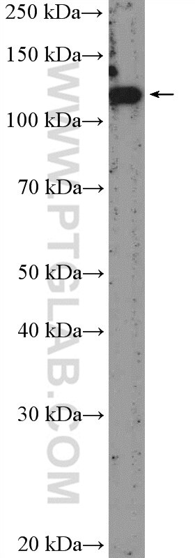 Western Blot (WB) analysis of mouse uterus tissue using BNC2 Polyclonal antibody (55220-1-AP)