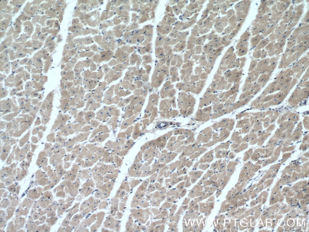 IHC staining of human heart using 15964-1-AP