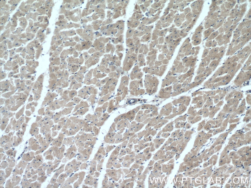 Immunohistochemistry (IHC) staining of human heart tissue using BNIP1 Polyclonal antibody (15964-1-AP)