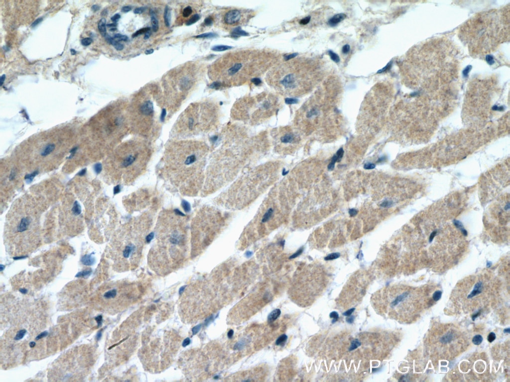 Immunohistochemistry (IHC) staining of human heart tissue using BNIP1 Polyclonal antibody (15964-1-AP)