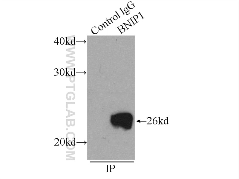 IP experiment of mouse brain using 15964-1-AP