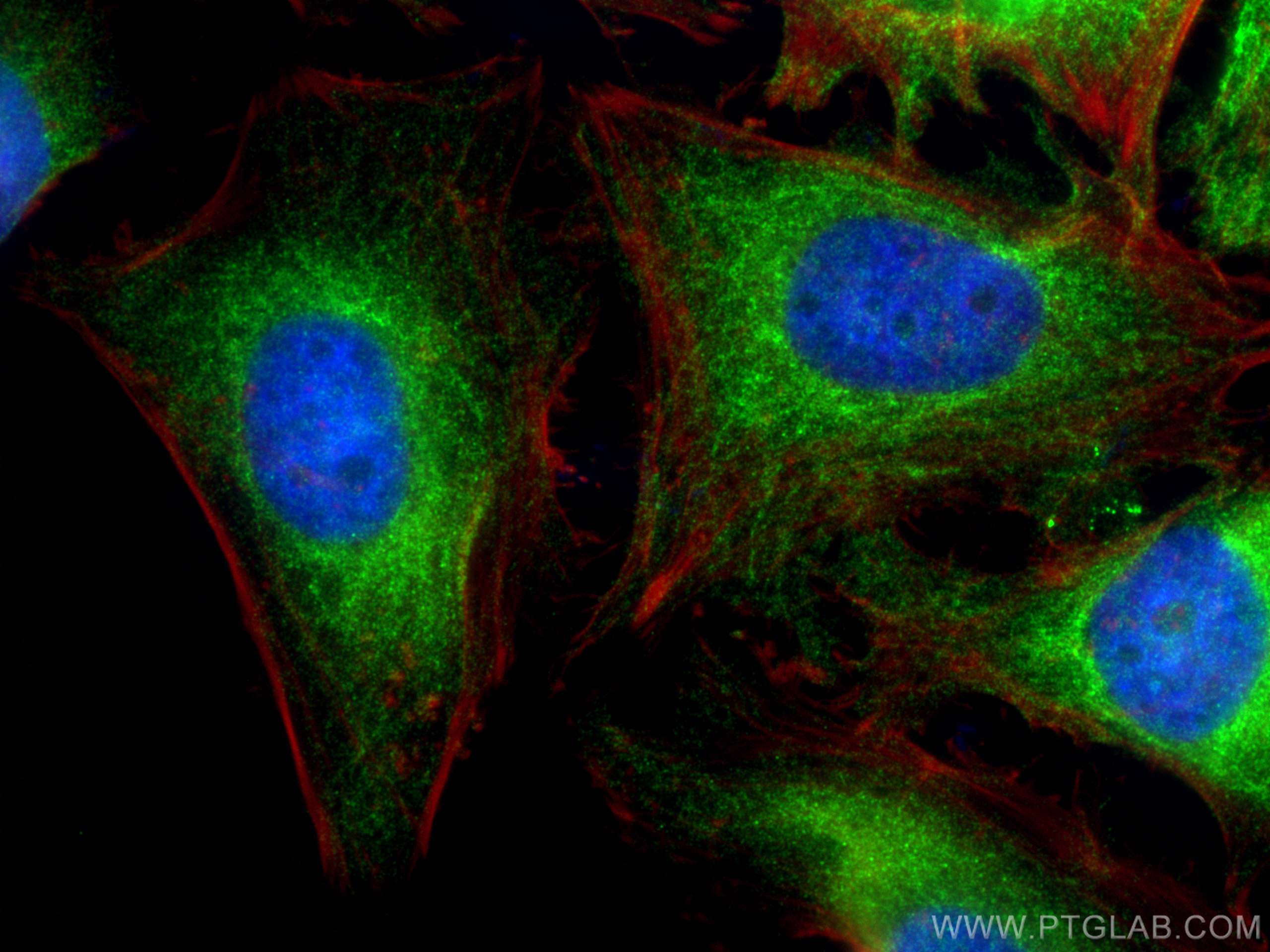 Immunofluorescence (IF) / fluorescent staining of HeLa cells using BNIP2 Polyclonal antibody (10361-1-AP)