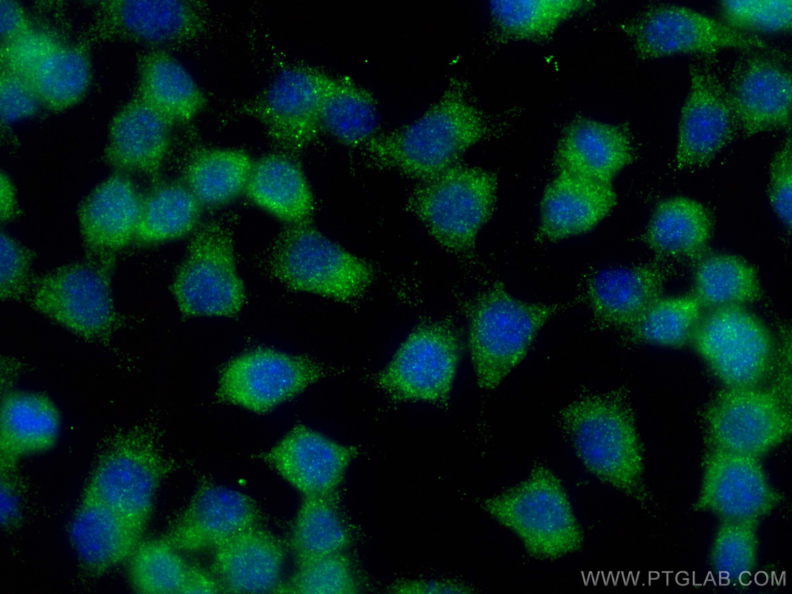 Immunofluorescence (IF) / fluorescent staining of RAW 264.7 cells using BNIP2 Polyclonal antibody (10361-1-AP)