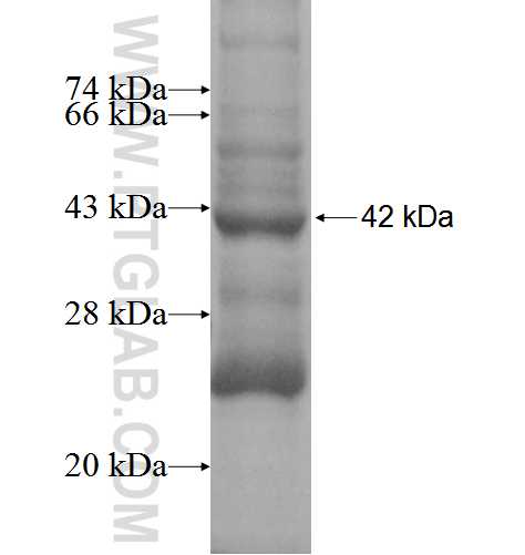 BNIP2 fusion protein Ag0403 SDS-PAGE