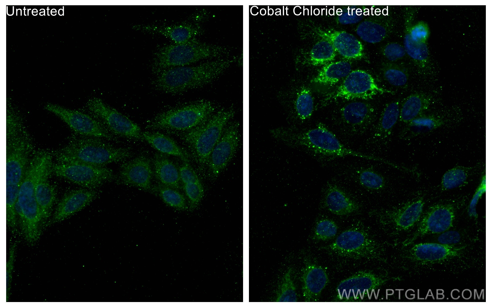 Immunofluorescence (IF) / fluorescent staining of HepG2 cells using BNIP3 Monoclonal antibody (68091-1-Ig)