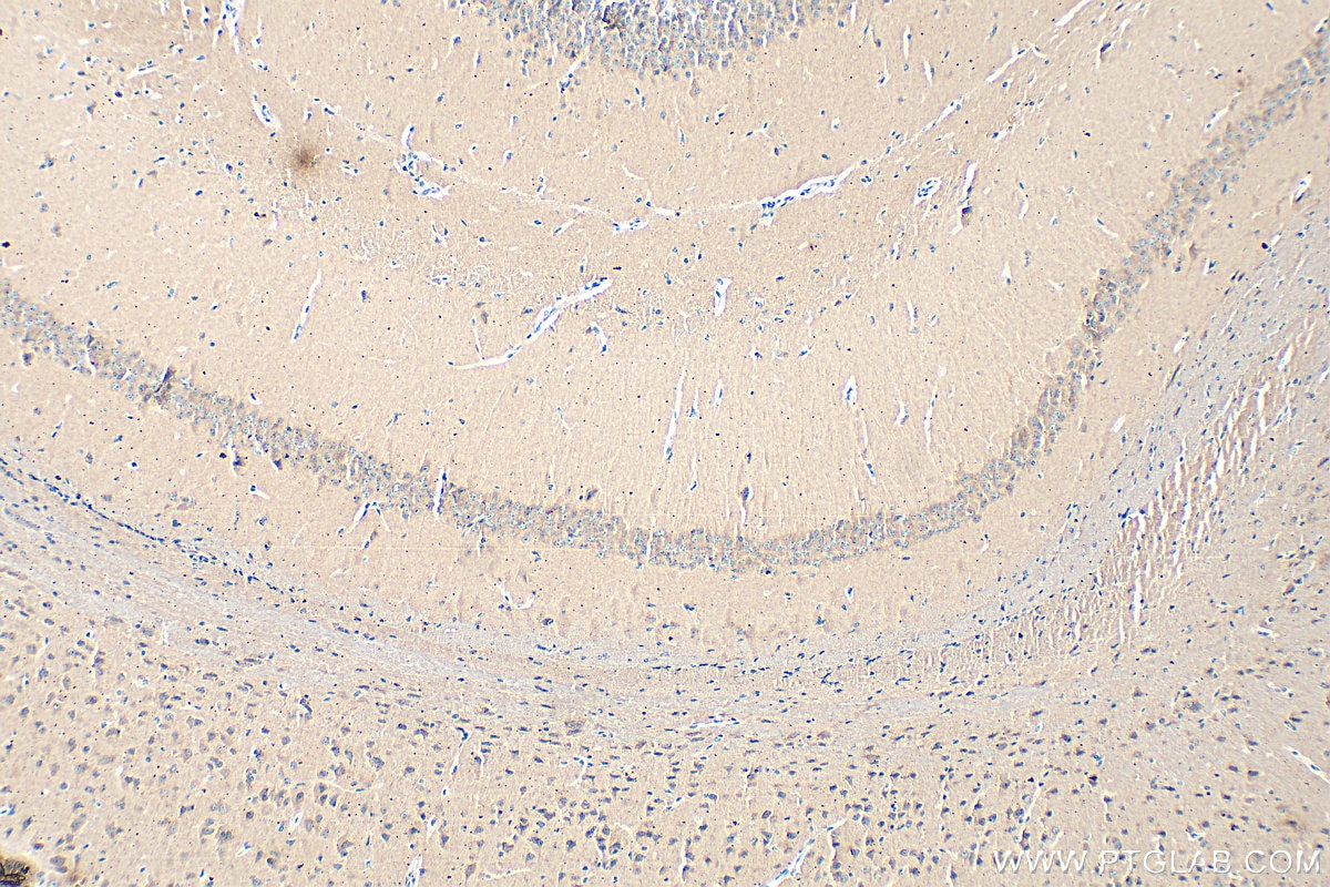 Immunohistochemistry (IHC) staining of mouse brain tissue using BNIP3 Monoclonal antibody (68091-1-Ig)