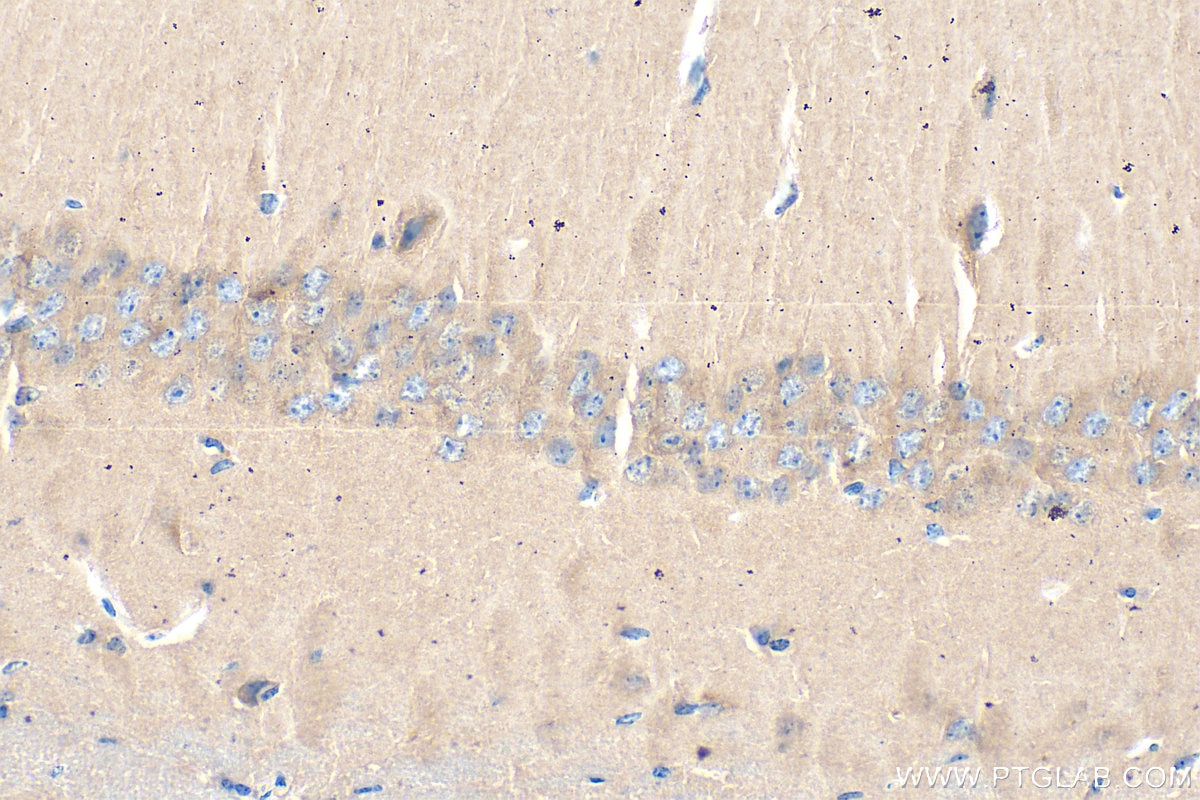 Immunohistochemistry (IHC) staining of mouse brain tissue using BNIP3 Monoclonal antibody (68091-1-Ig)