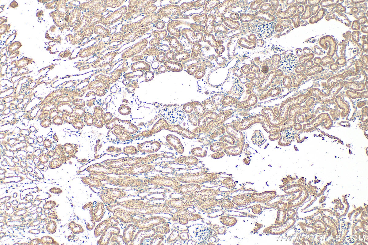 Immunohistochemistry (IHC) staining of mouse kidney tissue using BNIP3 Monoclonal antibody (68091-1-Ig)