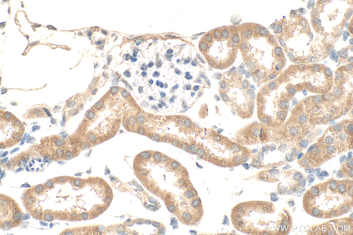 Immunohistochemistry (IHC) staining of mouse kidney tissue using BNIP3 Monoclonal antibody (68091-1-Ig)