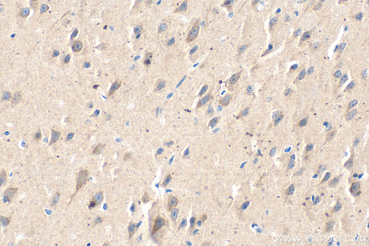 Immunohistochemistry (IHC) staining of mouse brain tissue using BNIP3 Monoclonal antibody (68091-1-Ig)