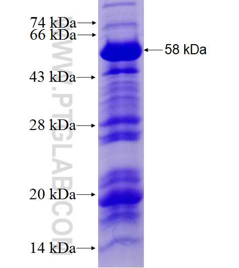BNIP3 fusion protein Ag27935 SDS-PAGE