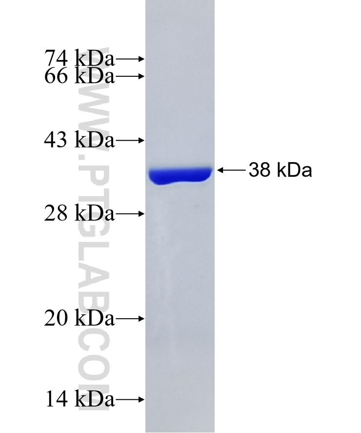 BNIP3 fusion protein Ag19747 SDS-PAGE