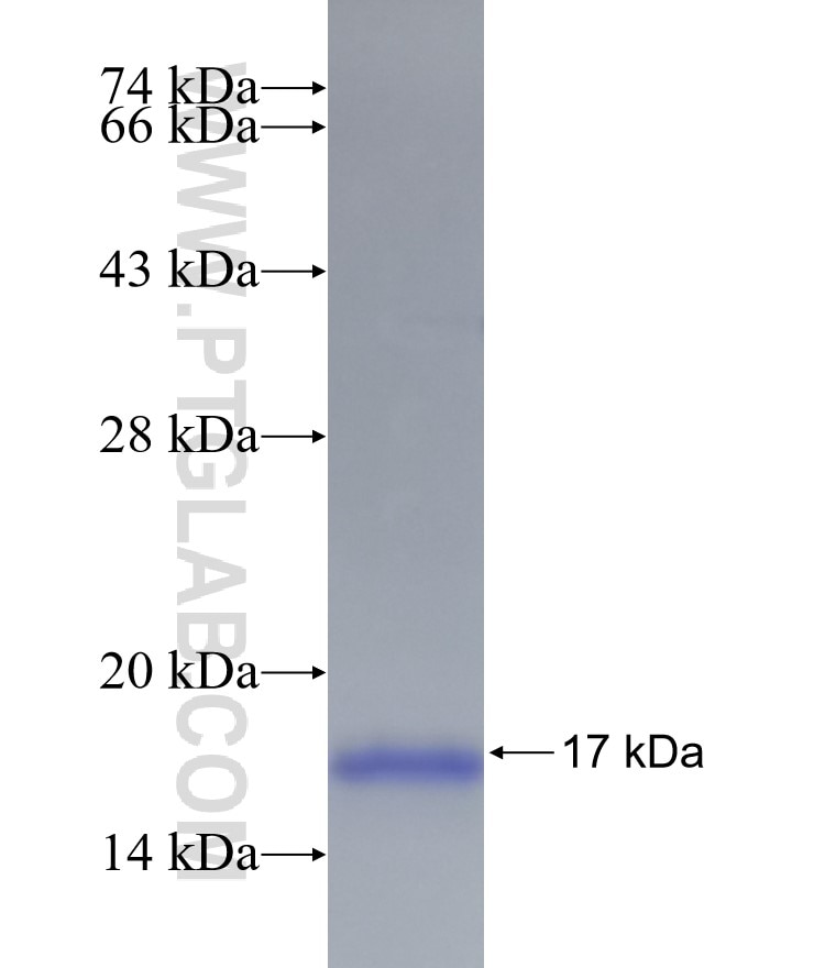 BNIP3 fusion protein Ag19755 SDS-PAGE
