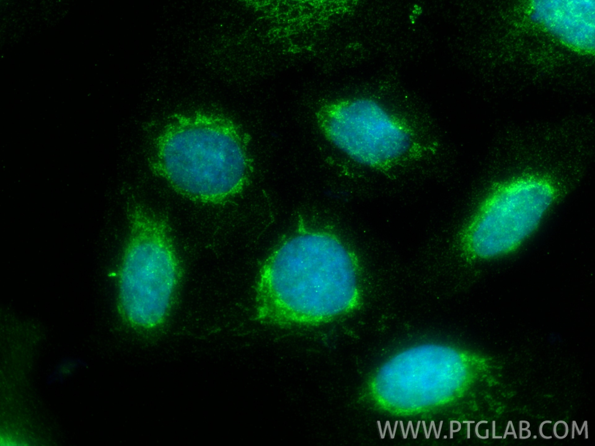 Immunofluorescence (IF) / fluorescent staining of U2OS cells using BNIP3L Polyclonal antibody (12986-1-AP)