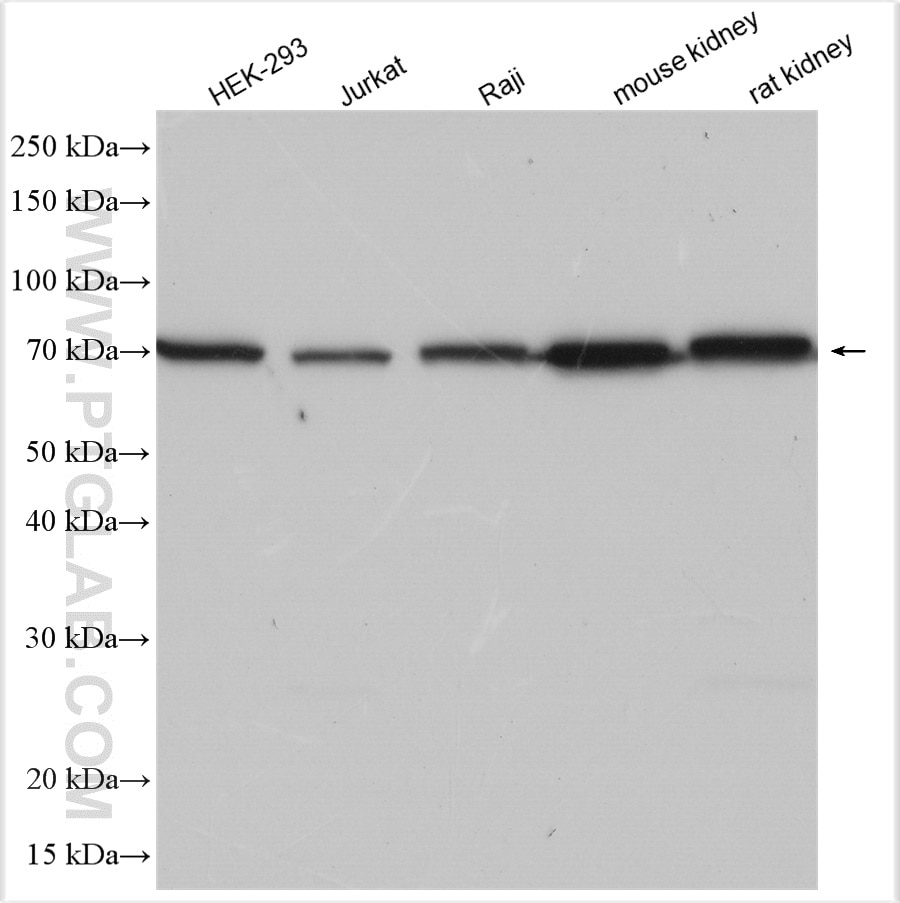 Western Blot (WB) analysis of various lysates using BNIP3L Polyclonal antibody (12986-1-AP)