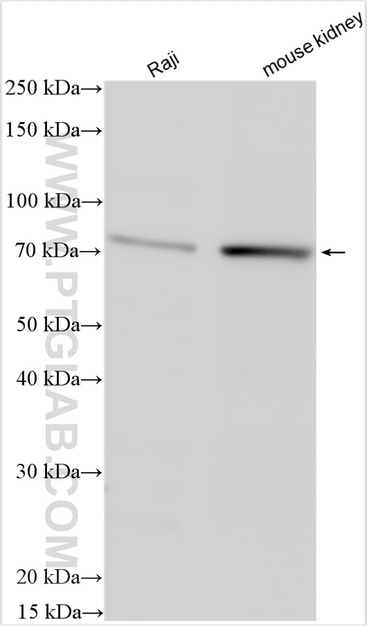 Western Blot (WB) analysis of various lysates using BNIP3L Polyclonal antibody (12986-1-AP)