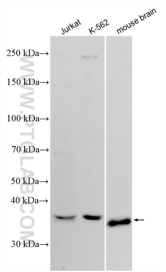 Western Blot (WB) analysis of various lysates using BNIP3L Polyclonal antibody (29848-1-AP)