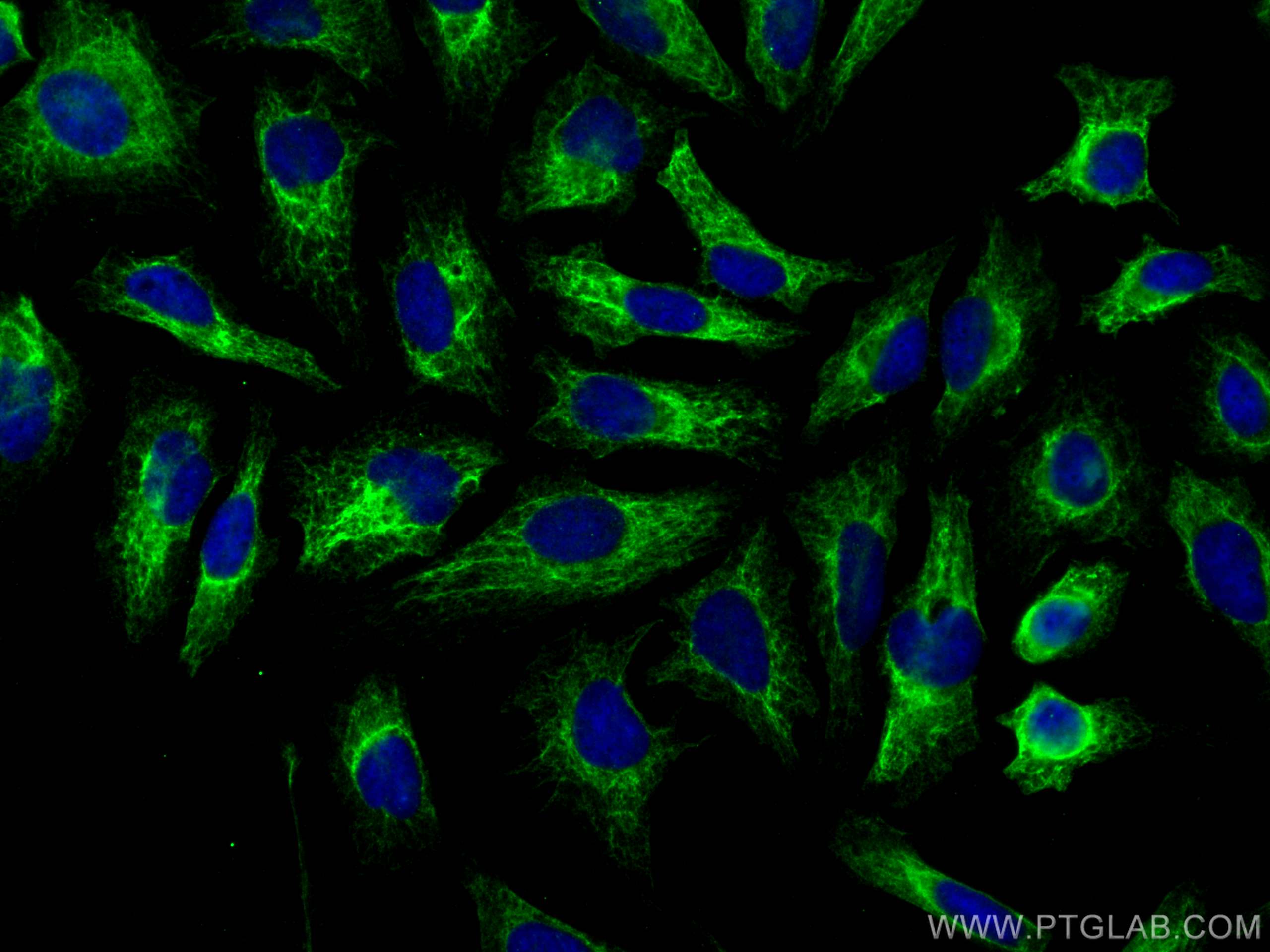 Immunofluorescence (IF) / fluorescent staining of HeLa cells using BNIP3L Monoclonal antibody (68118-1-Ig)
