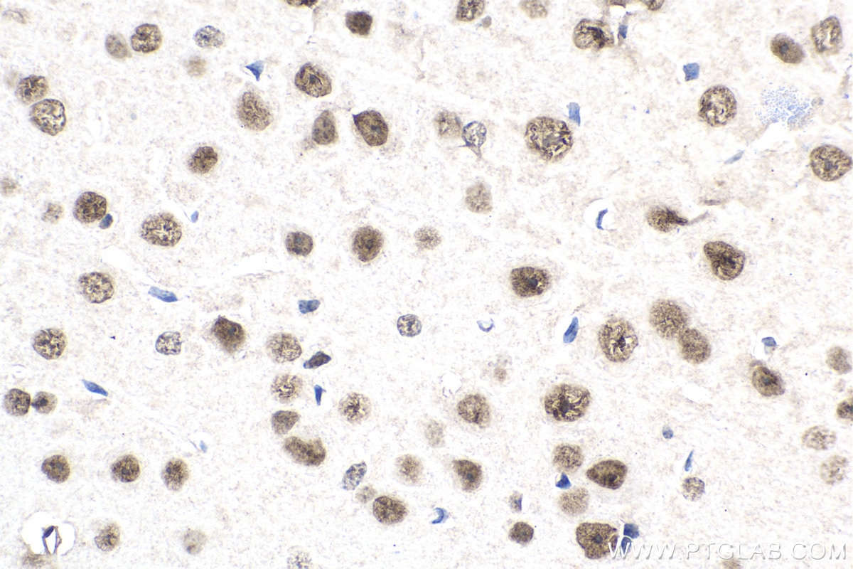 Immunohistochemistry (IHC) staining of mouse brain tissue using BNIP3L Monoclonal antibody (68118-1-Ig)