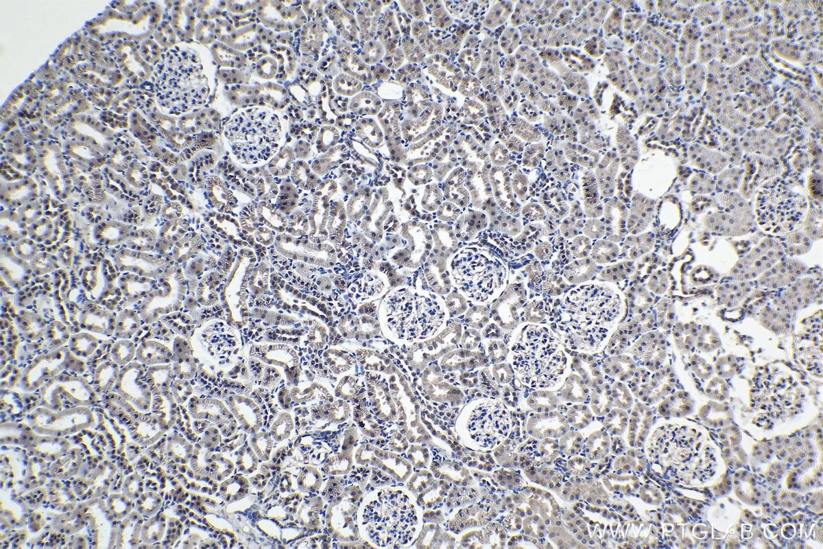 Immunohistochemistry (IHC) staining of rat kidney tissue using BNIP3L Monoclonal antibody (68118-1-Ig)