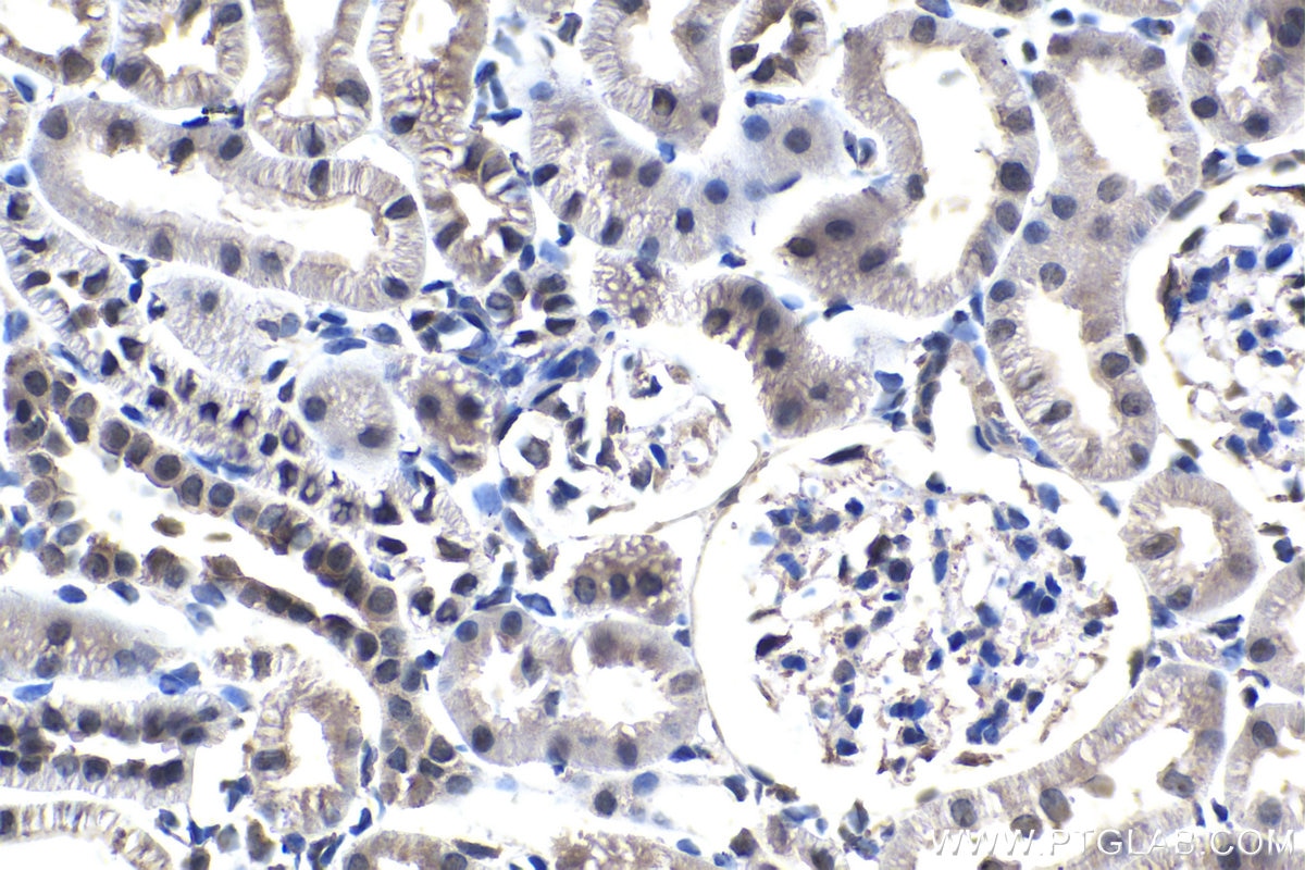Immunohistochemistry (IHC) staining of rat kidney tissue using BNIP3L Monoclonal antibody (68118-1-Ig)
