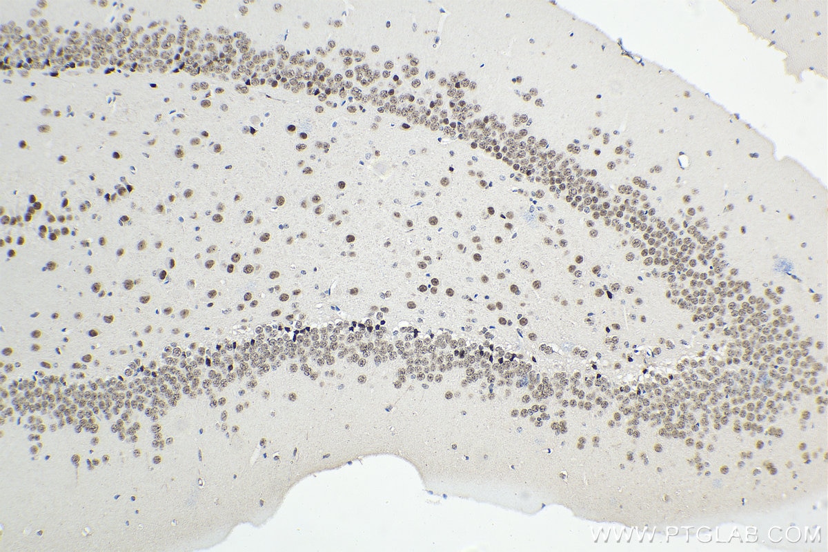 IHC staining of mouse brain using 68118-1-Ig
