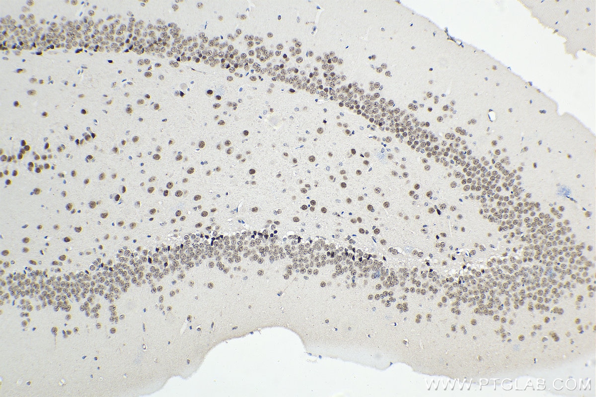 Immunohistochemistry (IHC) staining of mouse brain tissue using BNIP3L Monoclonal antibody (68118-1-Ig)