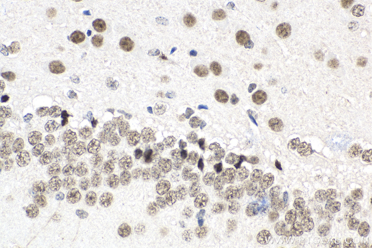Immunohistochemistry (IHC) staining of mouse brain tissue using BNIP3L Monoclonal antibody (68118-1-Ig)
