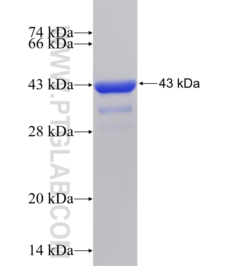 BNIP3L fusion protein Ag31514 SDS-PAGE