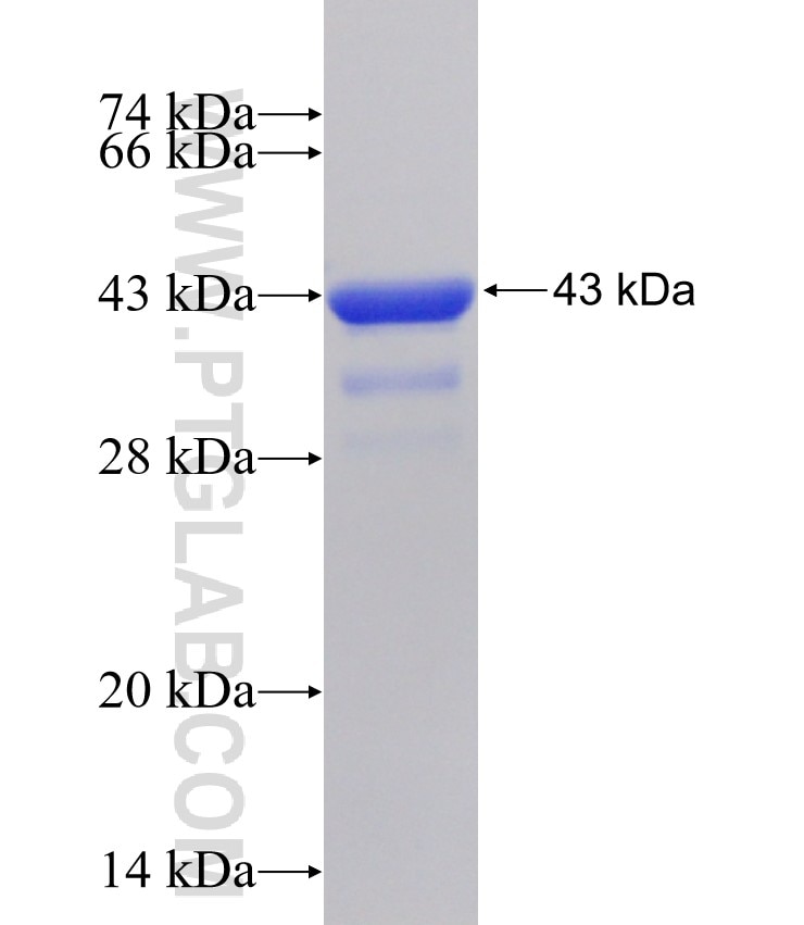 BNIP3L fusion protein Ag31514 SDS-PAGE BNIP3L fusion protein Ag31514 SDS-PAGE