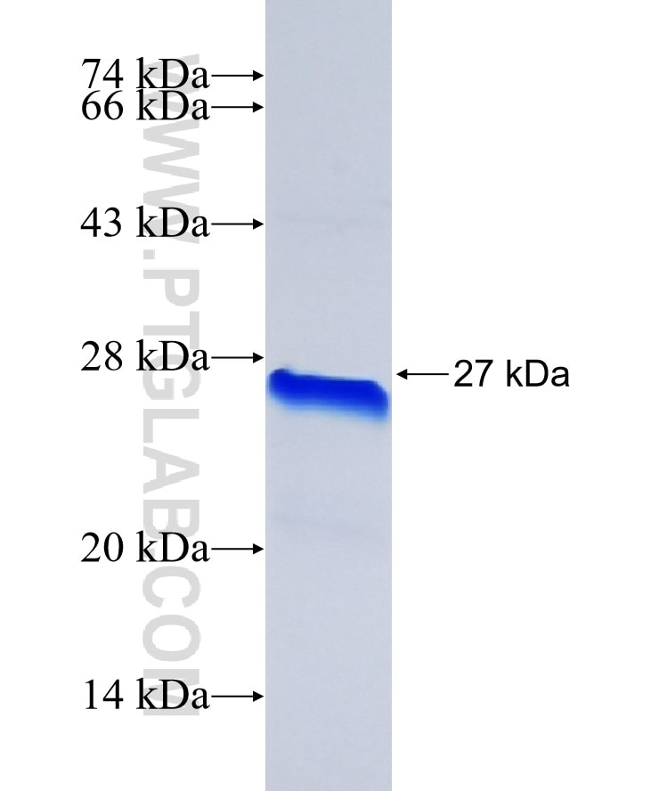 BNIP3L fusion protein Ag31547 SDS-PAGE