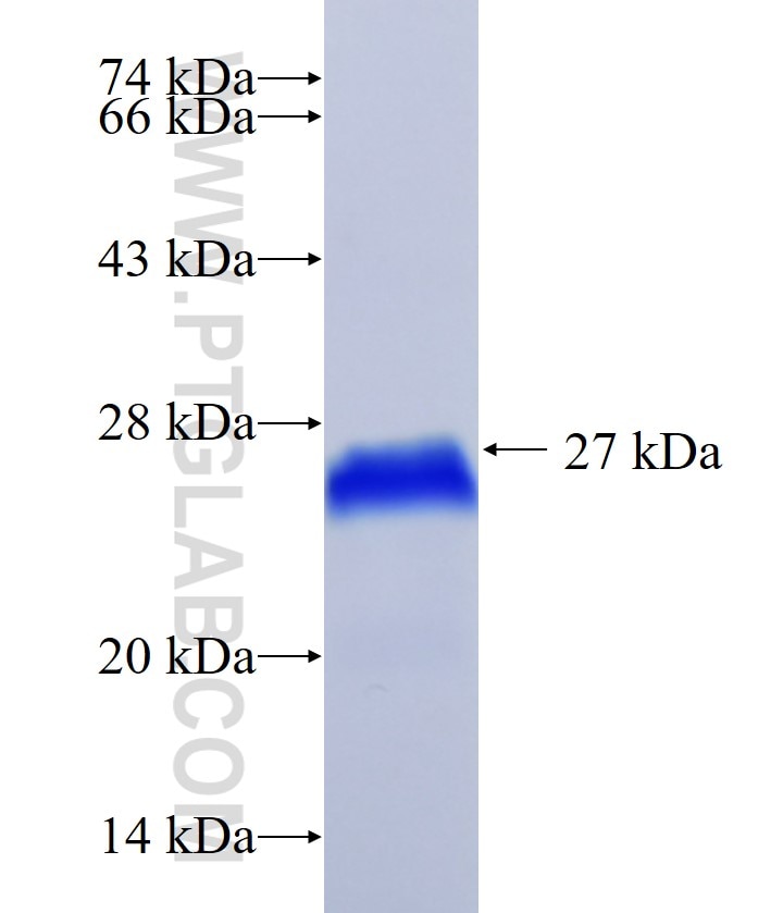 BNIP3L fusion protein Ag31547 SDS-PAGE