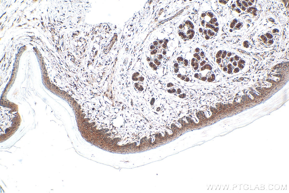 Immunohistochemistry (IHC) staining of mouse skin tissue using BNIPL Polyclonal antibody (13262-1-AP)