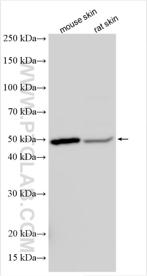 Western Blot (WB) analysis of various lysates using BNIPL Polyclonal antibody (13262-1-AP)