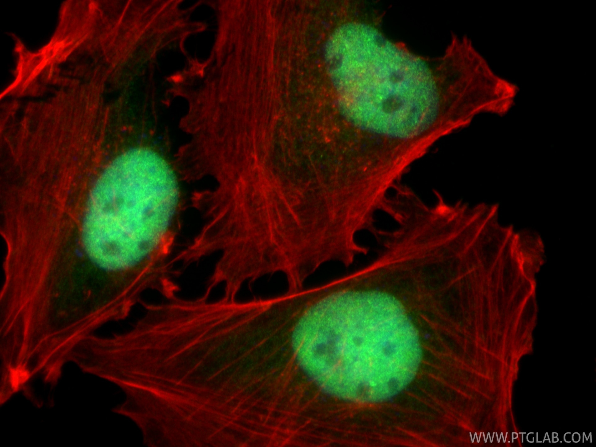 Immunofluorescence (IF) / fluorescent staining of U-251 cells using BOD1L Polyclonal antibody (31560-1-AP)