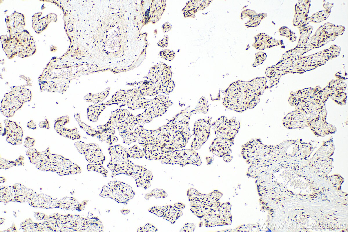 Immunohistochemistry (IHC) staining of human placenta tissue using BOD1L Polyclonal antibody (31560-1-AP)