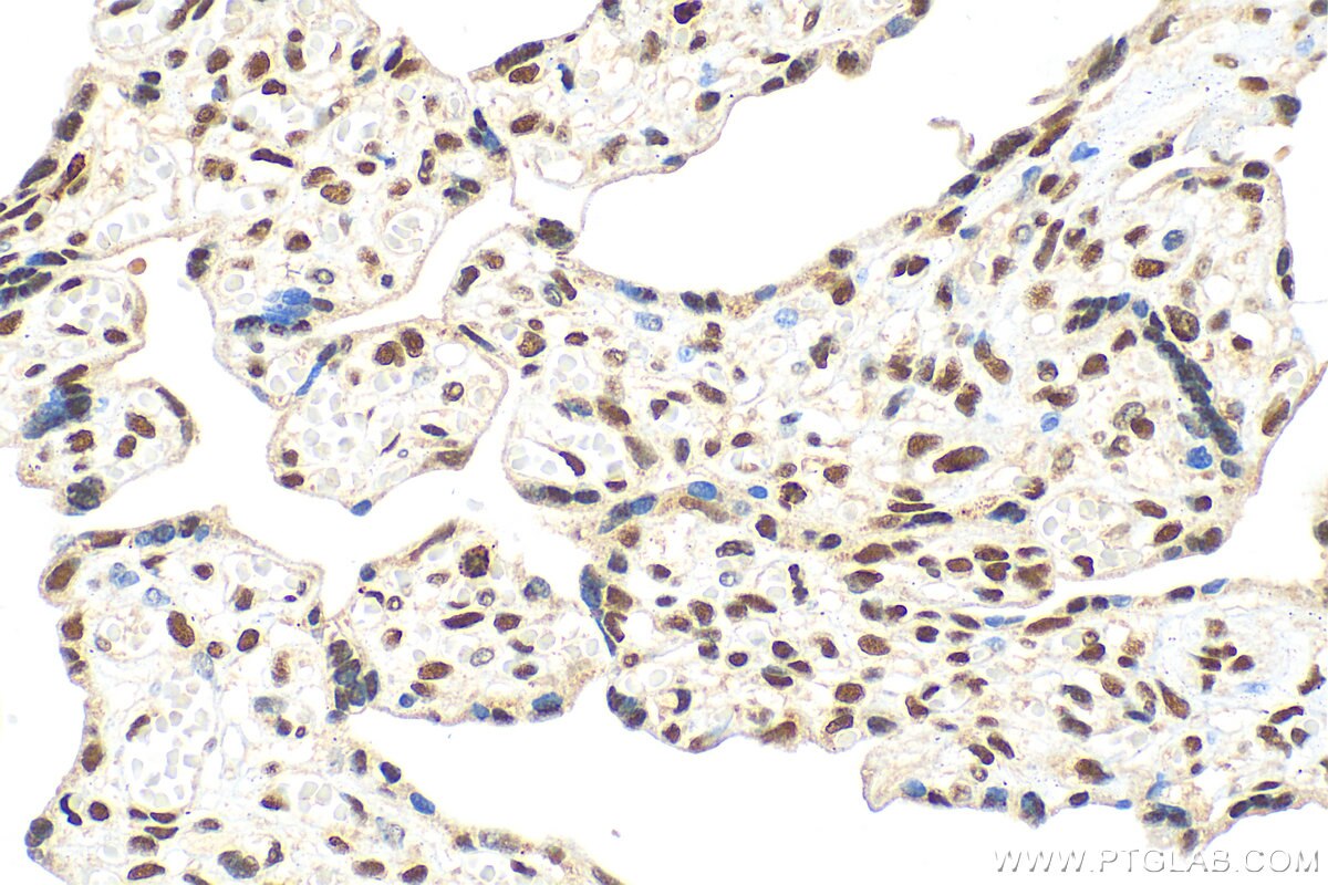 Immunohistochemistry (IHC) staining of human placenta tissue using BOD1L Polyclonal antibody (31560-1-AP)