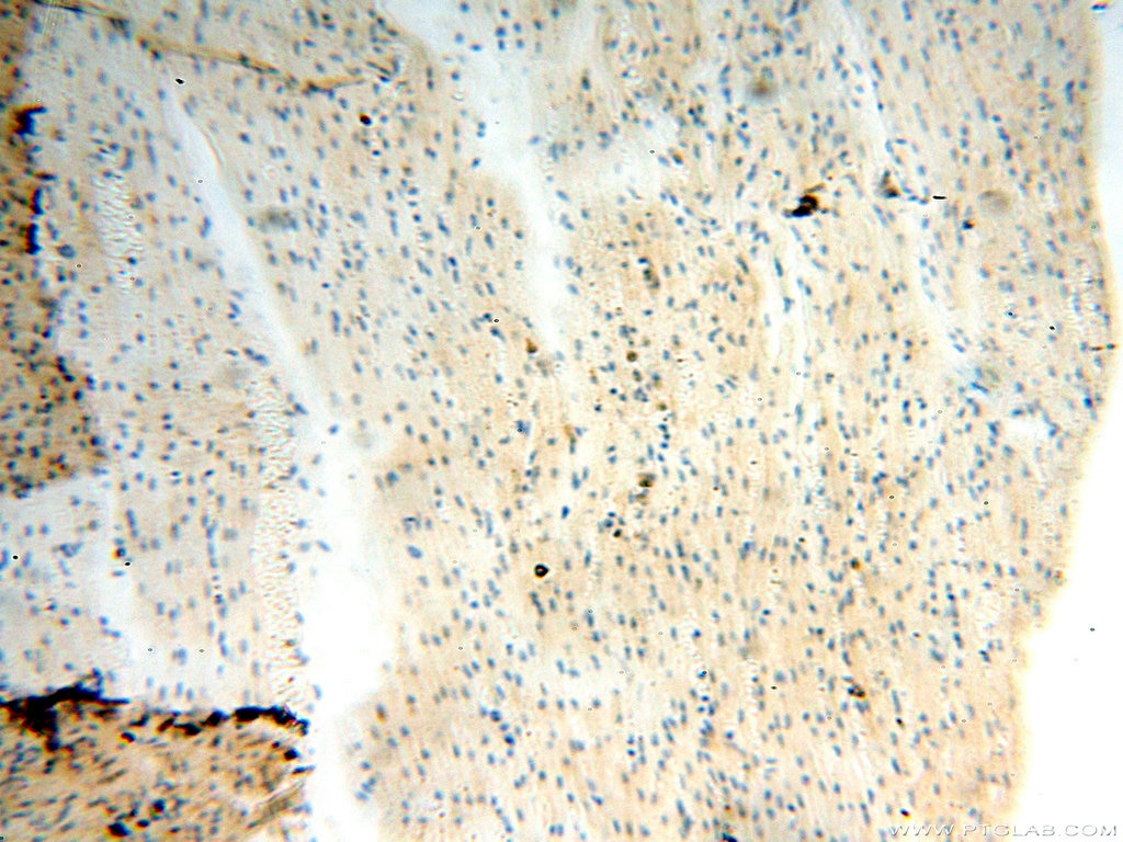 Immunohistochemistry (IHC) staining of human heart tissue using BOLA1 Polyclonal antibody (18017-1-AP)