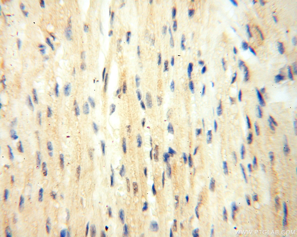 IHC staining of human heart using 18017-1-AP