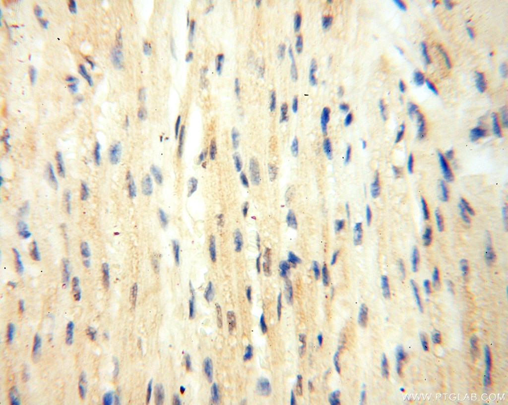 Immunohistochemistry (IHC) staining of human heart tissue using BOLA1 Polyclonal antibody (18017-1-AP)